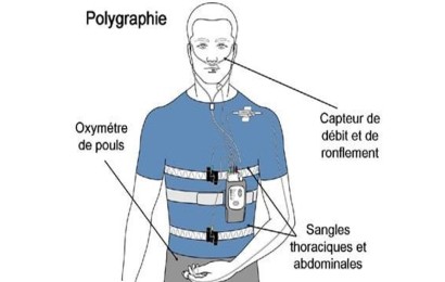 Polygraphie ventilatoire